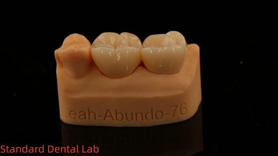 Buy Solid Dental Lab Crowns 3D Pro High Translucency Full Zirconia Crowns with 5-Year Guarantee online manufacture