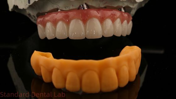 Buy 5 Year Guarantee Dental Implant Crown PMMA Bridge Over Multi Unit Abutments Customized Vita Shade online manufacture