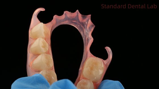 Buy Dental TCS Valplast Flexible Partial Dentures Dental Lab 3D Print Model High Esthetics online manufacture