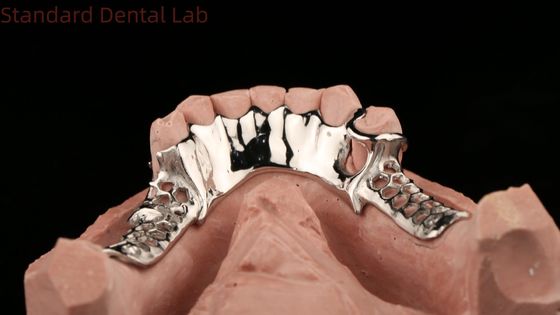 Buy Cobalt Chrome Cast Metal Framework Partial Dentures With Lower Apron Design SDL Dental Lab online manufacture