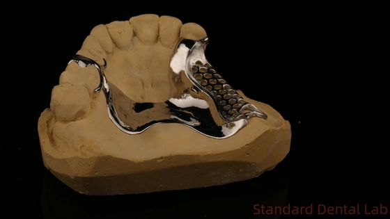 Buy High Strength 3D Printed Cast Framework COCR Partial Dentures Chrome Cobalt Cast Metal Framework online manufacture