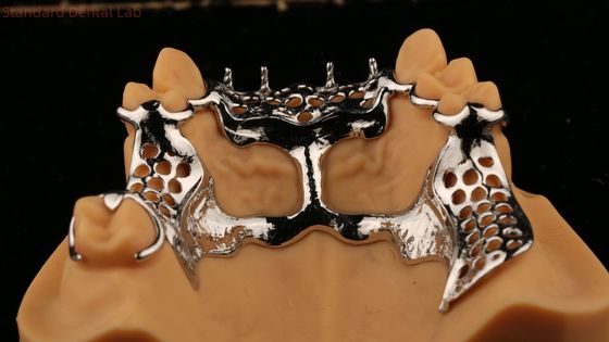 Buy Upper Cast Framework Acrylic Metal Partial Dentures Strong Lightweight and Durable online manufacture