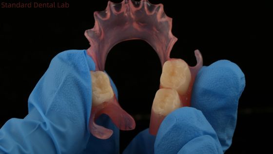 Buy Dental TCS Valplast Flexible Partial Dentures Nesbit Valplast Finish China Dental Lab Valplast Clasp online manufacture