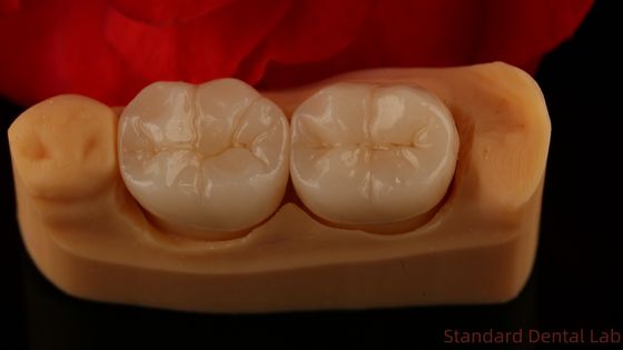 Buy Full Contour Zirconia Crown Exceptional Strength and Esthetics No Porcelian Overlay Posterior Crown China Dental Lab online manufacture