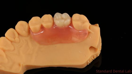 Buy Dental TCS Valplast Flexible Partial Dentures Nesbit Valplast Finish China Dental Lab Valplast Clasp online manufacture