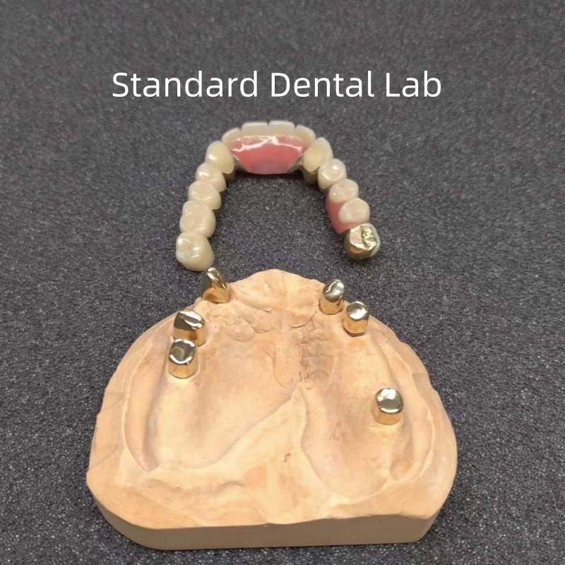 CAD CAM Tooth Partial Denture Attachment Dental Professional Accurate
