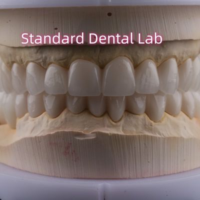 Dental Lab Full Arch Zirconia Porcelain Crowns PFZ Crown ISO FDA CE