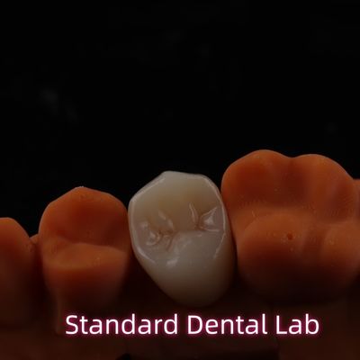 High Esthetic BruxZir Full Contour Zirconia Crowns PFZ Bridge