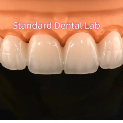 Zirconia Crowns Bridge Dental Lab With Layered Porcelain