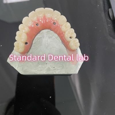 All On Four Six Ivoclar Zirconia Implant Bridge TItanium Bar With Pink Gum Porcelain