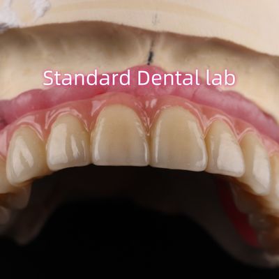 Fast Cement and Save Time Implant Products Dental Zirconia Crowns Bridge