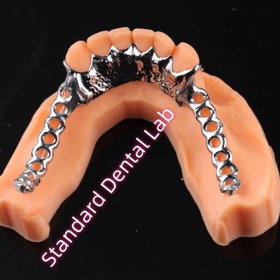 Laser Printing Cobalt Chrome Metal Framework Partial Denture Ni Be Free