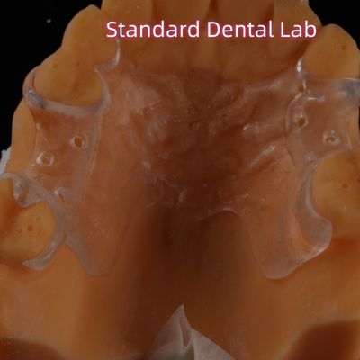 Removable Clear Acrylic Partial Denture Clasps Retentive Natural Looking