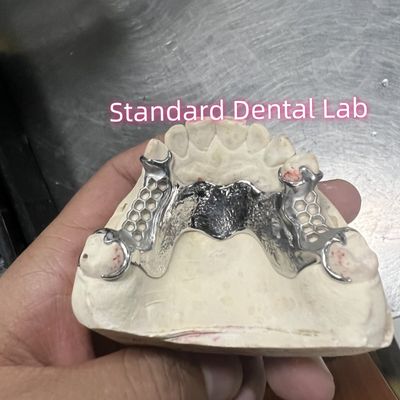 Cobalt Chrome Cast Frame Partial Denture Vitallium 2000