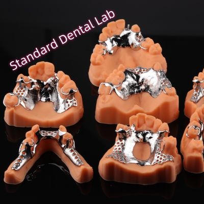CAD CAM Removable Partial Denture Metal Framework 3Shape Exocad Denture Design