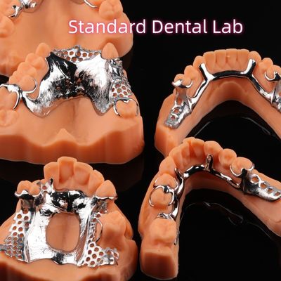 Printed CoCr Denture Skelete Chrome Metal Partial Denture Design