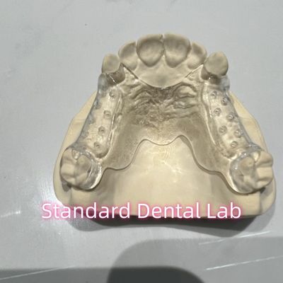 Removable Cast Clear Framework Partial Easy To Clean And Take Off