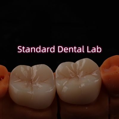 Full Contour Bruxier Monolithic Zirconia Crown Bridge Dental Lab