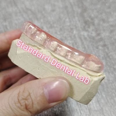 Bruxism Dental Occlusal Splint Night Guard Standard Dental Lab