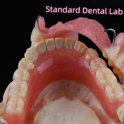 Removable Dental Restorations Acrylic Partial Denture Teeth With Wire Clasps