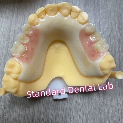 Upper Tooth Shade Acetal Framework Acrylic Clasp Removable Partial Dentures
