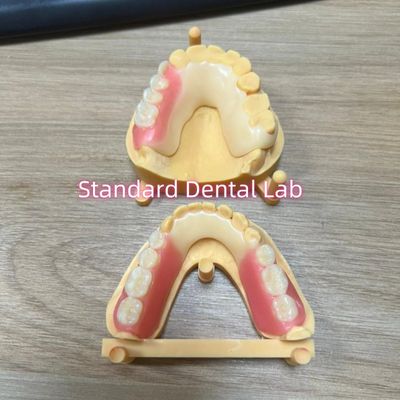 Esthetic Tooth Shade Acetal Framework  Tooth Coloured Clasps Ivoclar Set Up