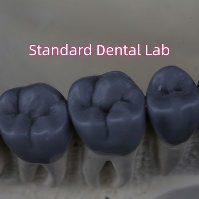Professional Digital Dental Lab Wax Up 3shape FDA Approved
