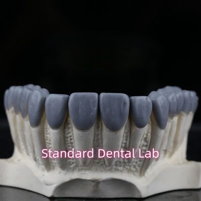 Standard Dental Lab Dental Crown Wax Up High Esthetics