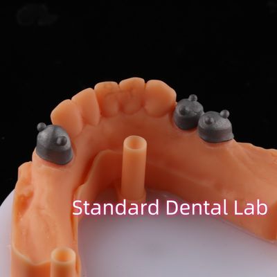 Telescope Crown Attachment Primary Secondary Crown Non Precious NP