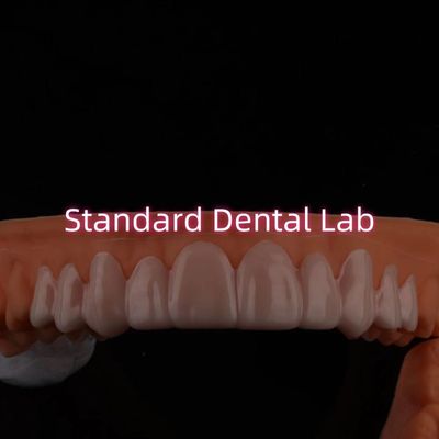 Dental Snap On Smile Veneers For Teeth Discolorations / Gaps