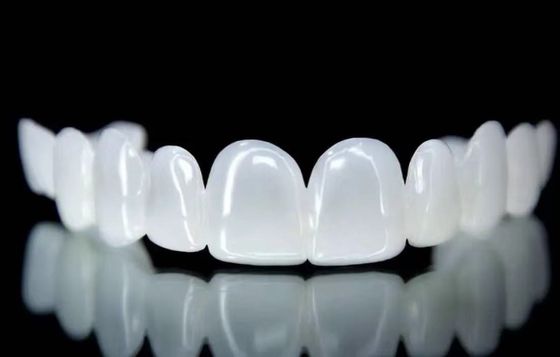 Removable Snap On Veneers Snow White Shade Good Fit Dental Design Service
