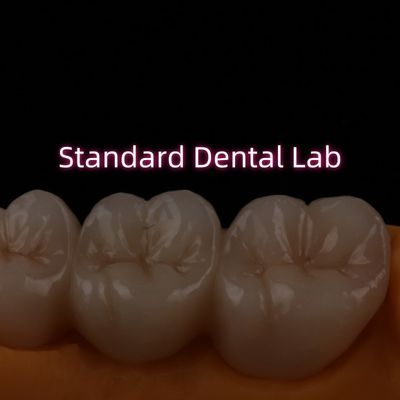 High Translucent PFZ Layered Zirconia Bridge Porcelain Ceramic Posterior