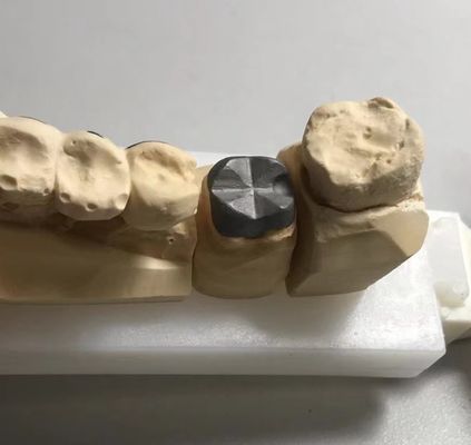 ISO FDA CE Dental Metal Post And Core Crown PFM Good Fit