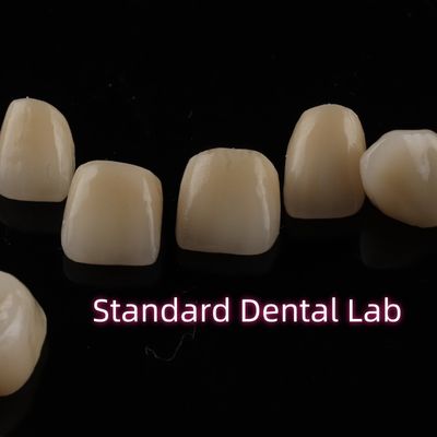 Dental Strong Layered Zirconia Crowns Full Upper Arch Restoration