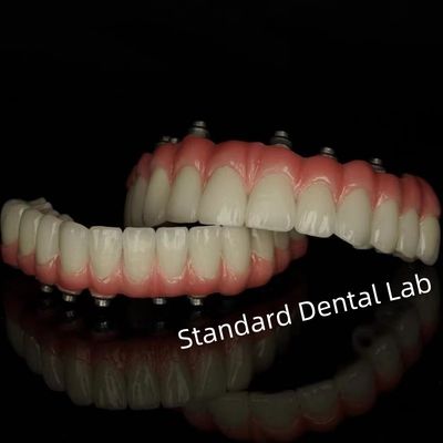 Implant Screw Cement Retained Dental Restorations from Standard Dental Lab