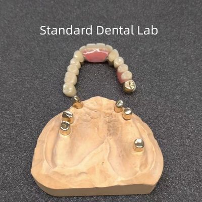 CAD CAM Tooth Partial Denture Attachment Dental Professional Accurate