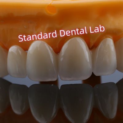 Anterior Restoration Zirconia Bridge Crowns For Missing Teeth