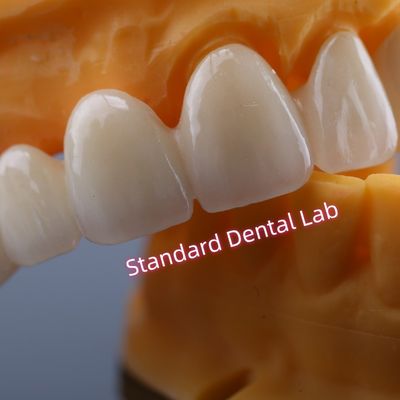 CAD CAM Mill Zirconia Crown Bridge Highly Biocompatible