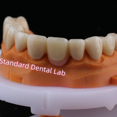 Digital CAD CAM Milling Layered Zirconia Bridge Crown With Pink Porcelain