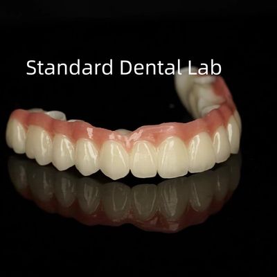 Esthetic Monolithic Porcelain Zirconia Crown Full Arch Translucency