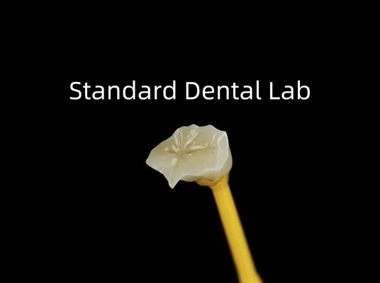 Dental Porcelain Inlay Onlay Zirconia Emax High Esthetics