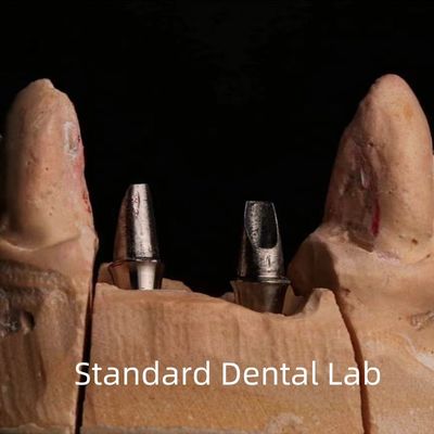 Dental Porcelain Zirconia Implant Crown Professional High Esthetics