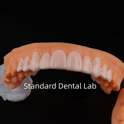 High Esthetics Dental Snap On Smile Standard Dental Lab