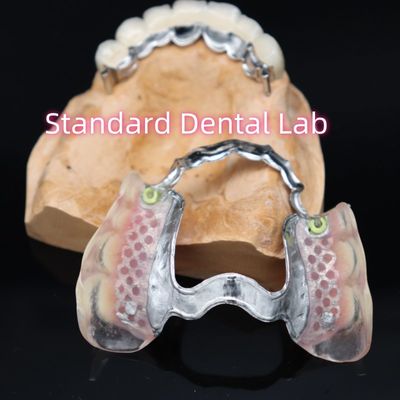 Removable Precision Attachment New Ace Valplast Partial Denture Pink / Dark