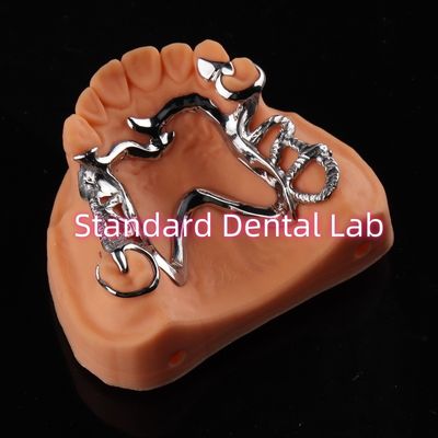 Cobalt Chrome Framework Ni Be Free removable dental prosthesis China Dental Lab