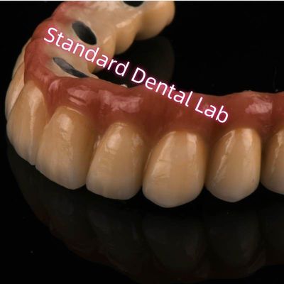 Cobalt Chrome Ivoclar Laser Sintered PFM Crown Metal Porcelain Bridge A1 A2 A3