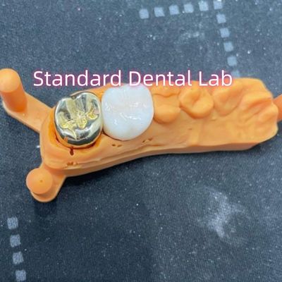 Non Precious Yellow Metal Alloy Crown Full Cast With Zirconia Crown