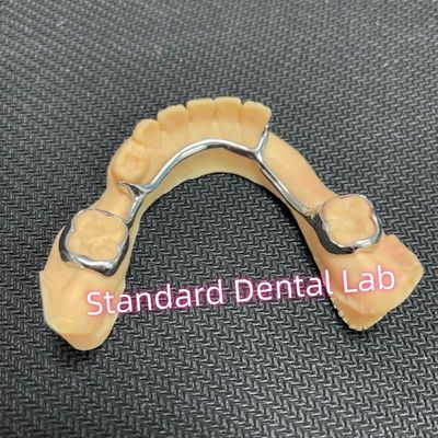 Dental Bilateral Space Maintainer For Missing Teeth Lingual Holding Arch