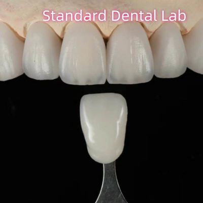 High Aesthetic Natural Customized Aidite Zirconia Dental Bridge