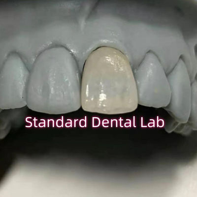 Restorative Dentistry Emax Dental Zirconia Porcelain Crowns